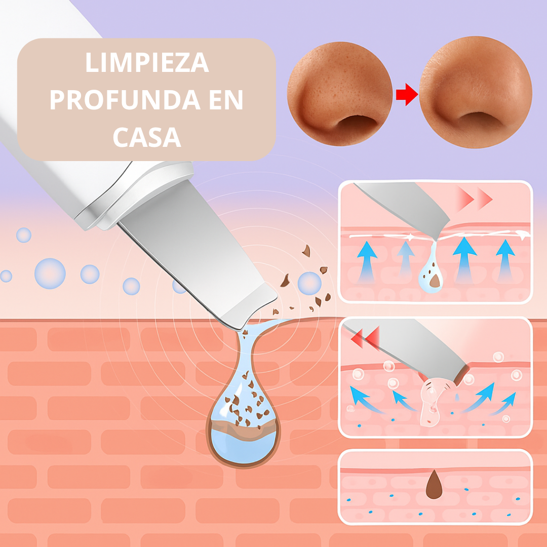 ESPÁTULA DE LIMPIEZA ULTRASÓNICA