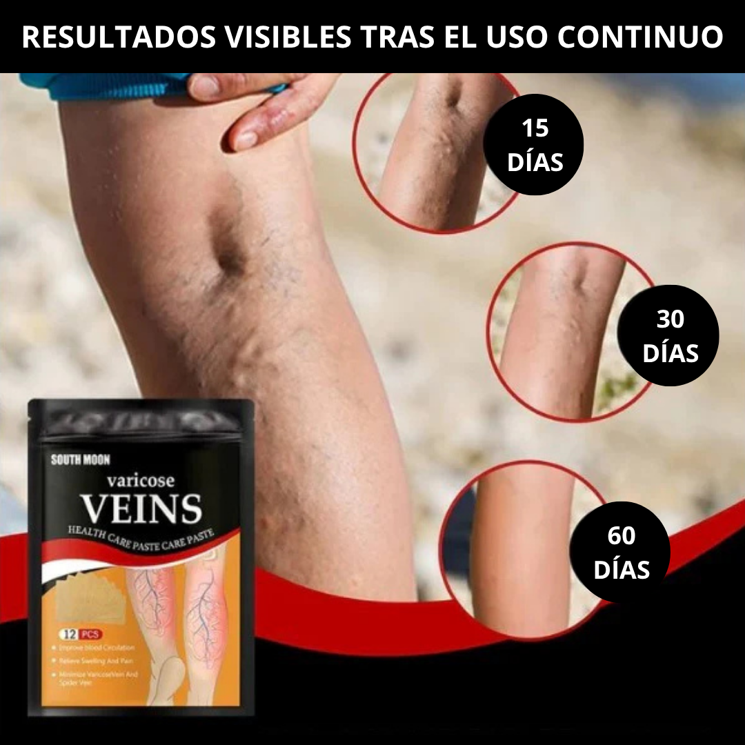 PARCHES PARA VÁRICES